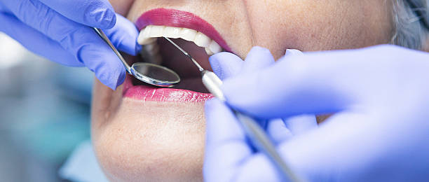 Best Emergency Root Canal Treatment in Chlicothe, IL